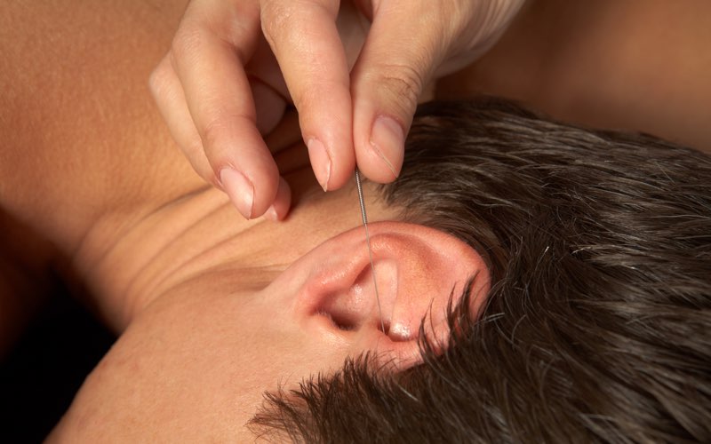 oor acupunctuur in Den Haag